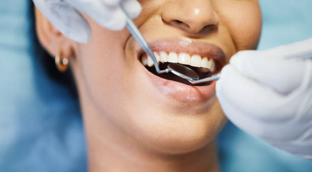 Best Broken Tooth Emergency  in Corte Madera, CA