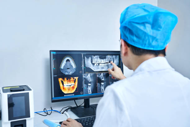 Best Dentist for Tooth Abscess  in Corte Madera, CA